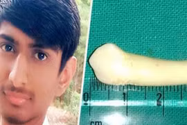 Nha sĩ bất ngờ phá kỷ lục Guinness với chiếc răng dài nhất thế giới