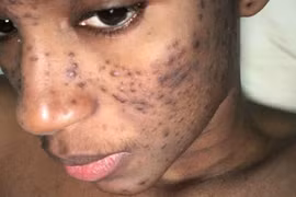 Tiêu tan sự nghiệp vì sản phẩm làm đẹp của một công ty Thụy Sỹ