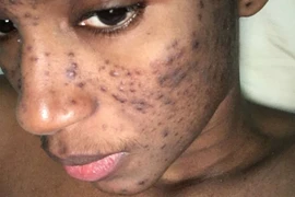 Tiêu tan sự nghiệp vì sản phẩm làm đẹp của một công ty Thụy Sỹ