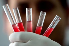 Video: Nhóm máu hiếm nhất thế giới chỉ có 43 người sở hữu