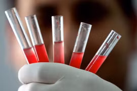 Video: Nhóm máu hiếm nhất thế giới chỉ có 43 người sở hữu