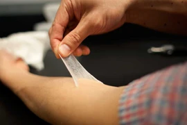 Nga chế tạo vải "da nhân tạo" để băng vết thương