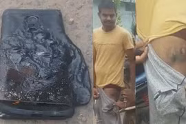 Smartphone "nhái" Galaxy Note 7 bất ngờ phát nổ trong túi người dùng