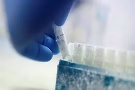 Đàn ông Mỹ đổ xô đi gửi tinh trùng vì sợ COVID-19