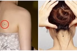 3 nốt ruồi cản trở tài lộc, 4 nốt ruồi phú quý đừng xóa đi