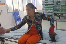 Người phụ nữ bị máy xay thịt ‘nuốt’ gần hết bàn tay