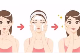 Đây là thần dược cứu cánh đối với da nhạy cảm, dễ nổi mụn 