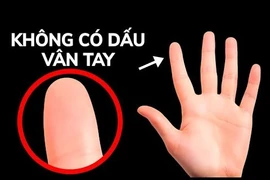 Video: Chuyện gì sẽ xảy ra nếu bạn mất dấu vân tay?