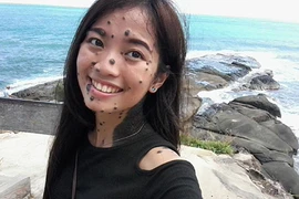 Cô gái có hàng trăm nốt ruồi gây bất ngờ khi thi HH Hoàn vũ
