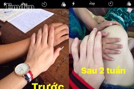 Bí kíp làm trắng da toàn thân sau 2 tuần hoàn hảo từ gạo rang