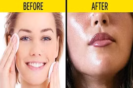 Da khô nẻ, nổi mụn vì dùng sai cách 8 sản phẩm làm đẹp này