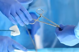 Hoại tử vì dùng thuốc xịt để nâng cao bản lĩnh đàn ông