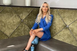 Người mẫu cụt chân vào chung kết hoa hậu