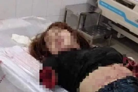 Ghen tuông, người đàn ông ở Đồng Nai chém lìa hai tay vợ