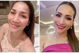 Ngỡ ngàng nhan sắc của Hồng Ngọc sau 3 năm bị bỏng