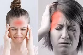 Cơn đau đầu ở những vị trí khác nhau phản ánh điều gì? 