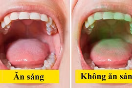 5 điều bạn nên làm mỗi ngày để hơi thở thơm mát