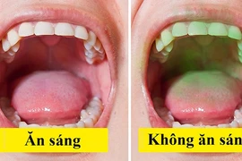 5 điều bạn nên làm mỗi ngày để hơi thở thơm mát