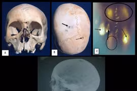 Người Ai Cập cổ đại có tỷ lệ mắc ung thư thấp, bí quyết là gì?