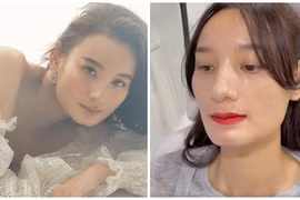 Lê Thúy công khai chỉnh sửa điểm này trên gương mặt
