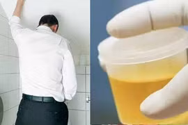 Thấy 4 thay đổi này khi đi tiểu, kiểm tra càng sớm càng tốt