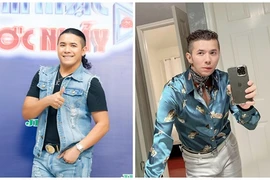 Kasim Hoàng Vũ thay đổi không nhận ra sau phẫu thuật xương hàm