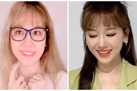 Bị liệt cơ mặt trái, Hari Won giờ thế nào?