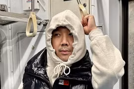 Trấn Thành vướng nghi vấn dao kéo, từng chỉnh sửa gì?