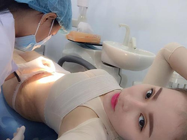 Cô đã quyết định thực hiện ca phẫu thuật tách mỡ bụng.