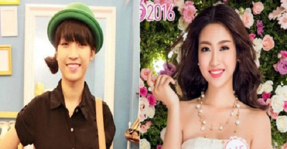 Tân Hoa hậu bị nghi chỉnh sửa răng, có vẻ đẹp không tự nhiên.