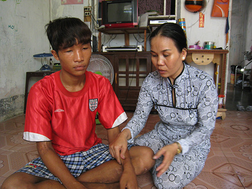 Nguyễn Hào Anh còn gọi là Hào Anh (Nguyễn Hoàng Anh) có người em sinh đôi là Nguyễn Hào Em (Nguyễn Hoàng Em) sống cùng mẹ là Phạm Thị Hoa ở thị trấn Cái Nước (Cà Mau).