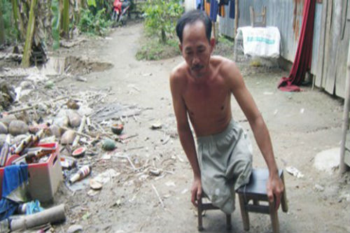 19 tuổi đã thành thương binh cụt hai chân nhưng ông Trần Thanh Tùng (49 tuổi, ngụ ấp Thới Bình, phường Phước Thới, quận Ô Môn, TP.Cần Thơ) vẫn bơi xuồng giăng lưới, lặn lội mò tôm cá, thậm chí leo dừa thuê kiếm sống như những người khỏe mạnh khác. Ông Tùng là một tấm gương thương binh vượt khó.