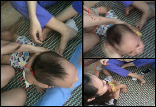 4. Bé 15 tháng tuổi bị 3 bảo mẫu trói chân tay, nhét rẻ vào miệng Trưa ngày 5/10, chị Đinh Thị Thuý Hằng (trú ở phường Hải Thành, TP Đồng Hới) quyết định mở camera theo dõi xem con trai Cù Hoàng Phi Long (15 tháng tuổi, học tại cơ sở mầm non Sơn Ca ở đường Hữu Nghị, TP Đồng Hới, Quảng Bình) đang làm gì ở trường, thì phát hiện cháu Long bị trói chặt chân tay về phía sau, miệng bị nhét giẻ,... Chiều 8/10, UBND TP Đồng Hới (Quảng Bình) ra quyết định xử phạt hành chính 22,5 triệu đồng với bà Trần Thị Thúy Hằng, chủ cơ sở mầm non Sơn Ca, đồng thời bà Hằng phải giải thể cơ sở mầm non trái phép Sơn Ca, trả lại các khoản thu của phụ huynh nếu có.