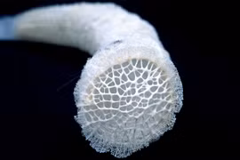 Kinh ngạc loài hải miên giỏ hoa với cấu trúc silica tinh xảo