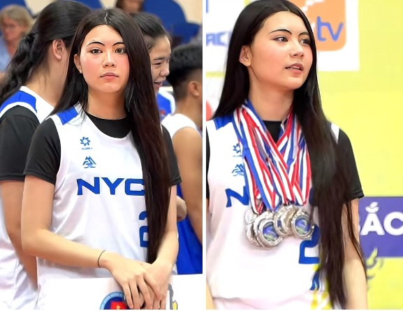 Nhiều netizen cho rằng Hạt Dẻ vừa can thiệp xăm chân mày, số khác lại cho rằng đó là do cách makeup hoặc tỉa chân mày quá đậm, tạo cảm giác thiếu tự nhiên, dừ hơn so với tuổi.