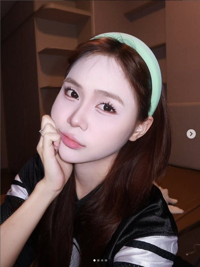 Với Kỳ Duyên, một trong những hot girl đình đám nhất nhì giới TikTok cũng không tránh khỏi những ý kiến trái chiều khi phẫu thuật thẩm mỹ.