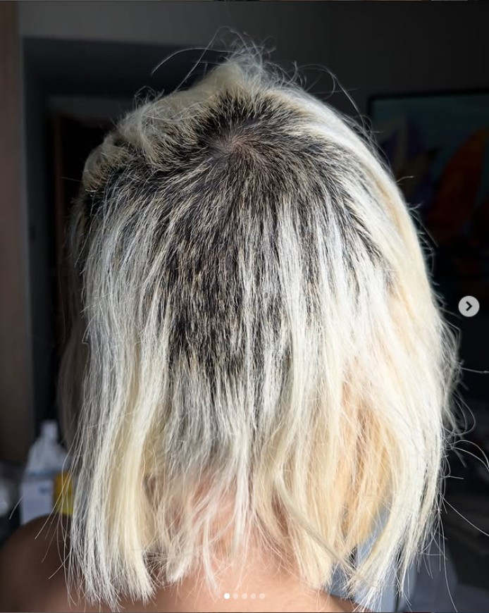 Nữ DJ hot nhất châu Á cho biết, salon đã để hóa chất quá lâu, khiến tình trạng tóc trở nên tồi tệ đến mức cô phải cạo bỏ hoàn toàn phần tóc phía sau và hai bên đầu.