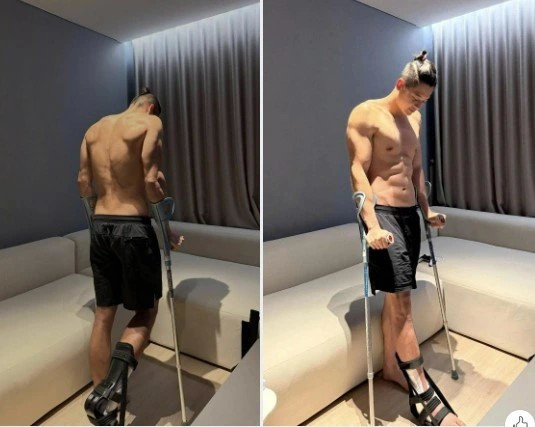 Nói về chấn thương gặp phải, Trí Thịt Bòa kể: "Lúc đó, Trí biết là gãy xương rồi nhưng vì bực quá nên không thấy đau. 10 phút sau, Trí nằm trên bệnh viện cấp cứu và sau đó bác sĩ đã nắn lại. 12 tiếng sau, bác sĩ đã phẫu thuật cho Trí".