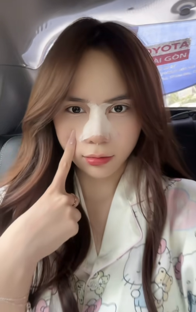 Trên trang cá nhân, hot TikToker khiến người hâm mộ tò mò khi đăng tải hình ảnh khoe góc nghiêng sau phẫu thuật thẩm mỹ.