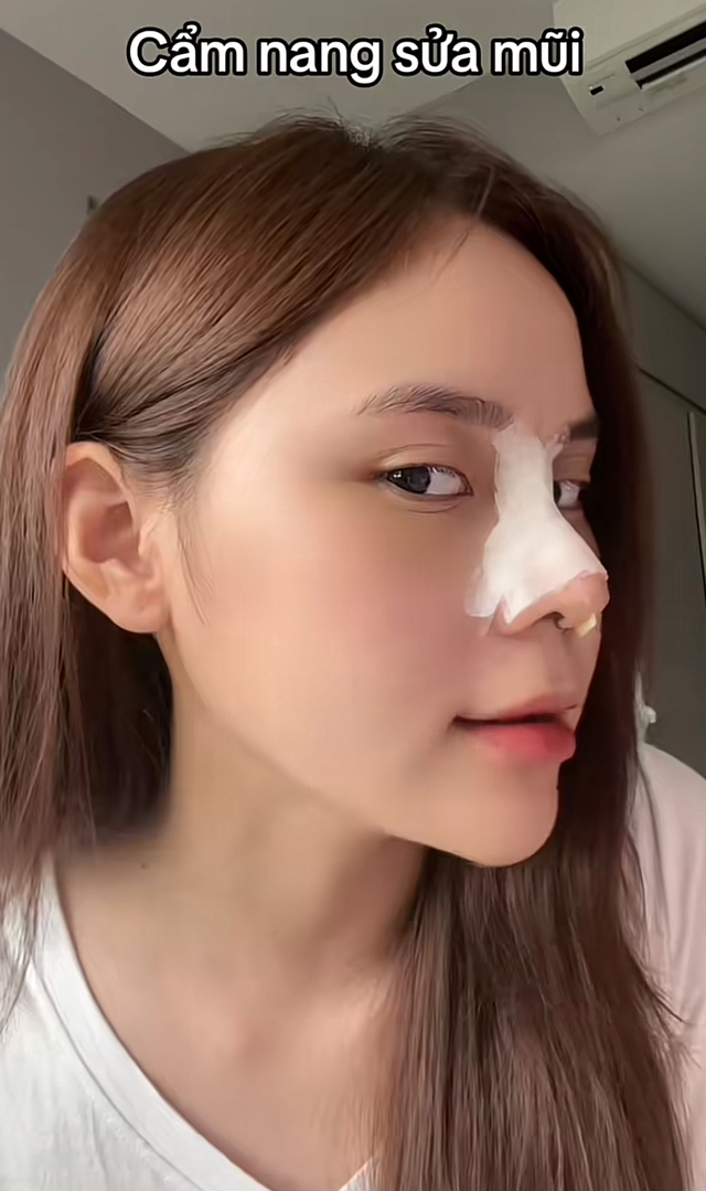 Mới đây, hot TikToker Kỳ Duyên đã chia sẻ về quá trình "làm mới" chiếc mũi của mình.
