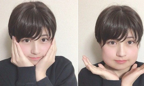 Mặt biến dạng vì mọc răng khôn, hot girl Nhật Bản vẫn gây sốt mạng