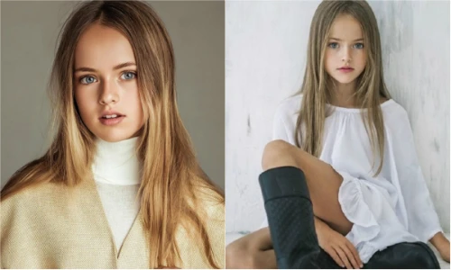 Thiên thần nhí đẹp nhất thế giới giờ ra sao?