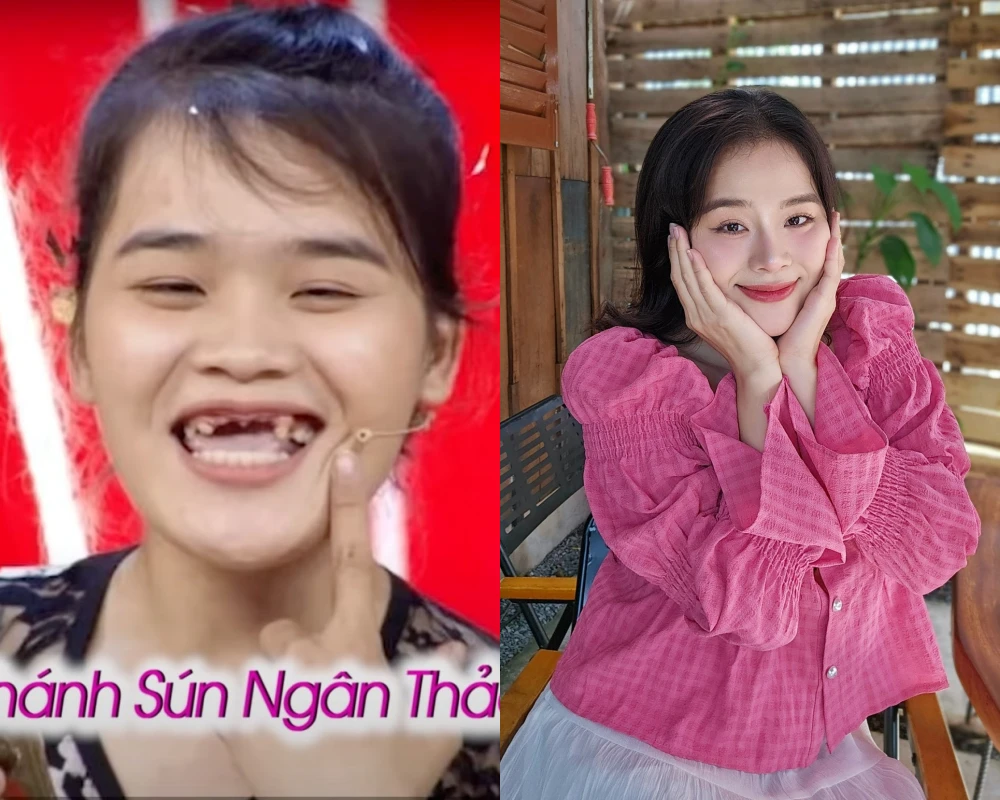 "Thánh sún" Ngân Thảo ra sao sau 6 năm nổi tiếng?