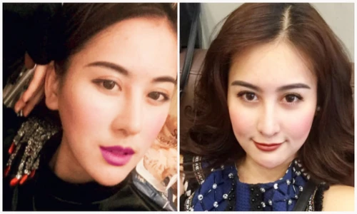 Hot girl Hà Lade để lộ chiếc cằm nhọn đáng nghi ngờ 