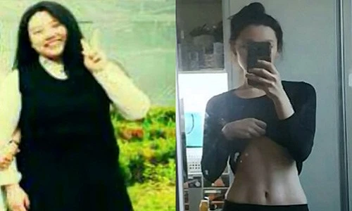 Giảm hơn 50kg, cô gái mũm mĩm bỗng thành "mỹ nữ bụng thon"