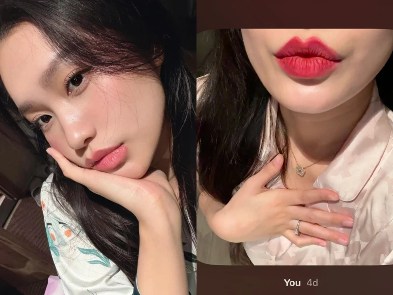 "Zoom" kỹ đôi môi của vợ Đoàn Văn Hậu sau thẩm mỹ