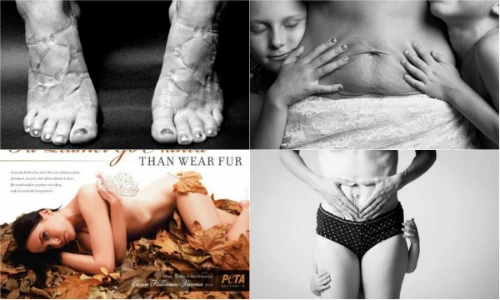 Bộ ảnh thời trang gây ám ảnh bởi sẹo lồi, bụng nhăn nhúm