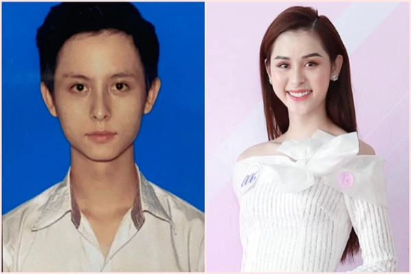 Người đẹp chuyển giới tiết lộ bí mật chuyện PTTM năm 17 tuổi