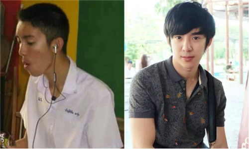 Thanh niên mặt mụn, răng hô hóa "soái ca" nhờ dao kéo