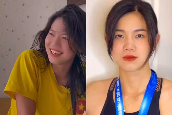 Ánh Viên lên tiếng về tin đồn phẫu thuật thẩm mỹ